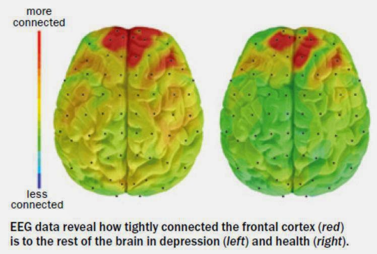 الاكتئاب مرض قاتل فما هي أسبابه؟