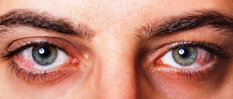 ‏‫نمط الحياة الصحي يسهم في حماية العين من اللصوص المتربصين بها