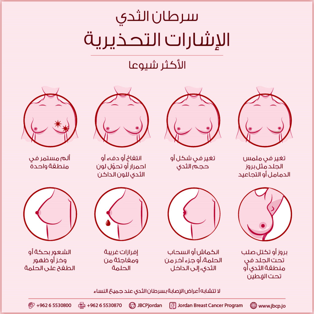 الاشارات التحذيرية - سرطان الثدي