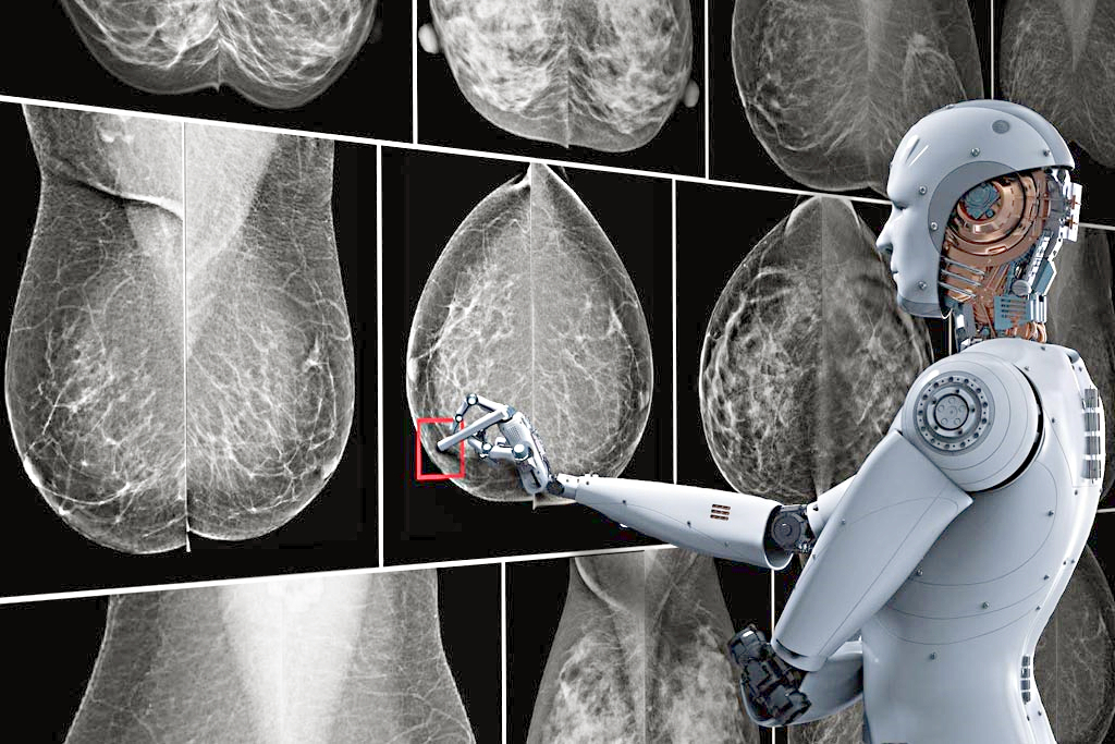 الذكاء الاصطناعي يتمكن من الكشف عن سرطان الثدي قبل فترة كبيرة من حدوثه