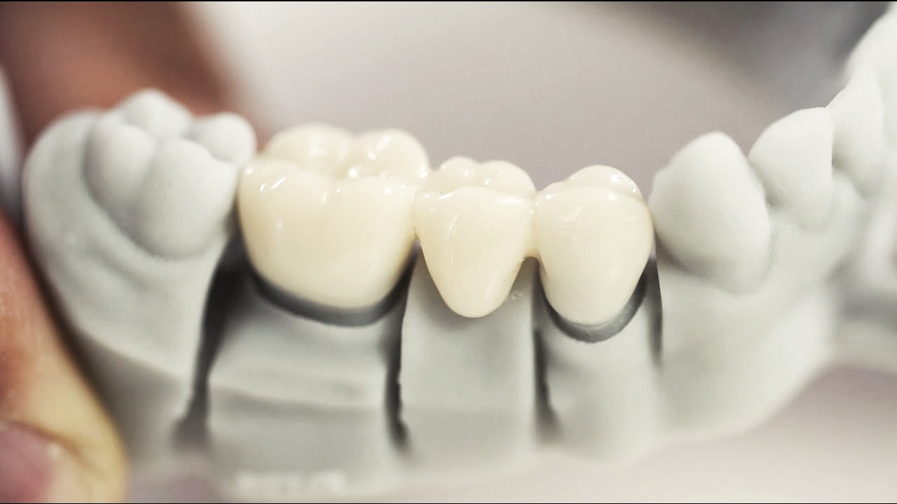 أسنان مقاومة للجراثيم بمساعدة الطباعة ثلاثية الأبعاد