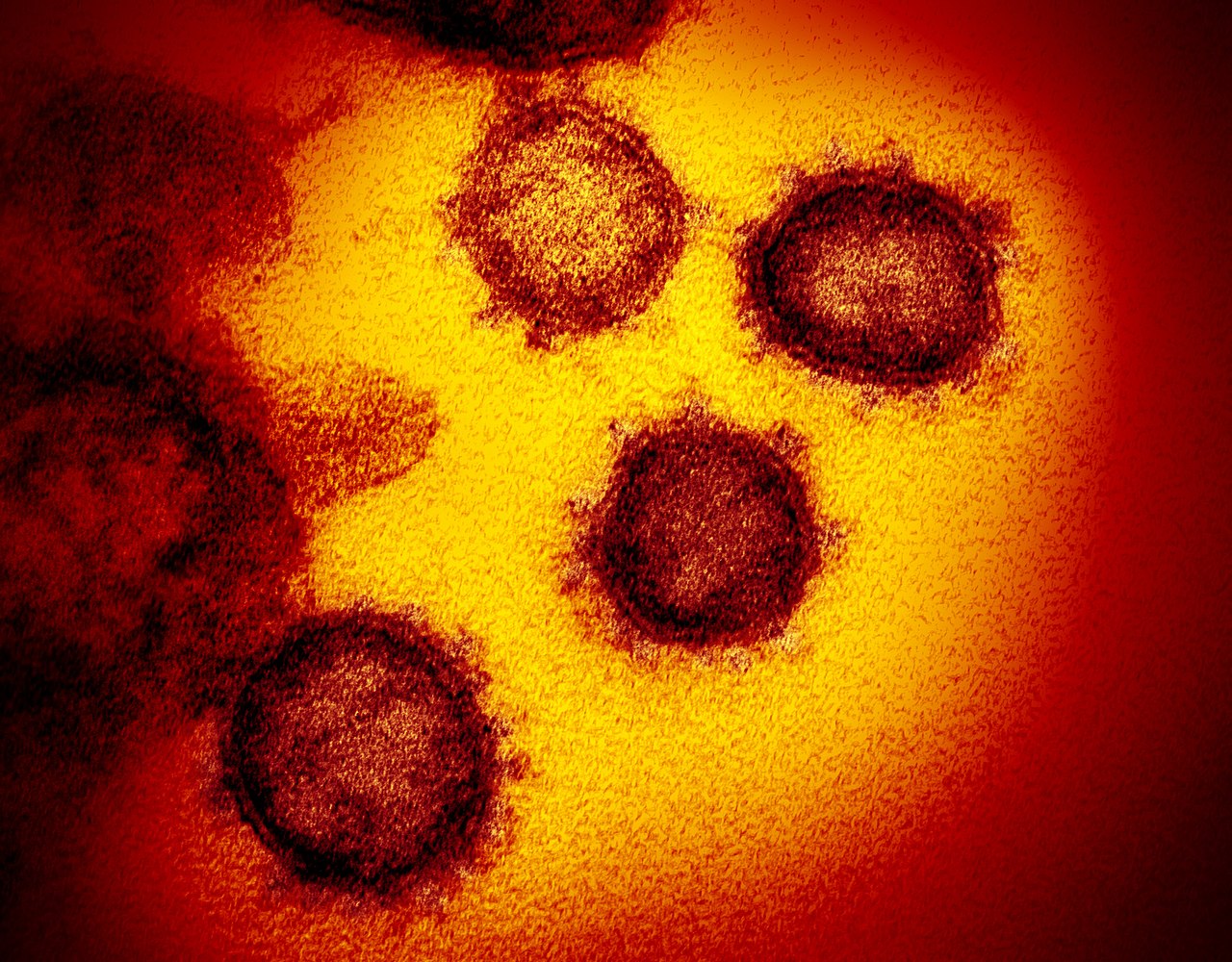 ما هو أصل فيروس الكورونا المستجد وهل هو حقاً صنيعة المختبرات؟