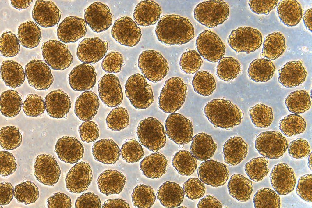 خلايا بيتا البنكرياسية - استخدام الخلايا الجذعية في علاج مرض السكري