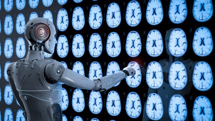 الذكاء الاصطناعي يكتشف علامات السكتة الدماغية في مراحلها الأولى
